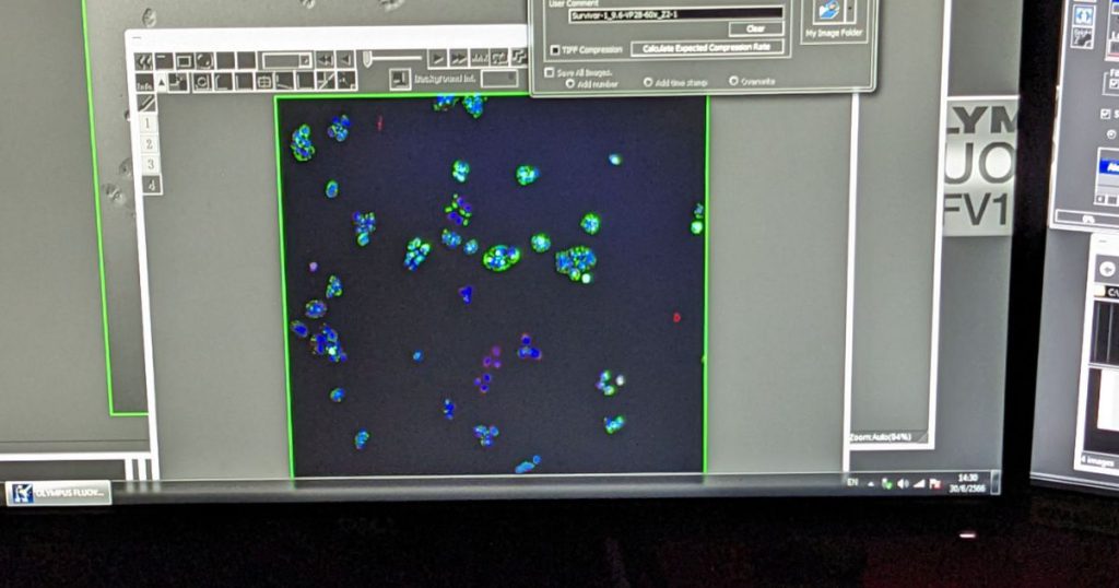 Immunofluorescence Staining: My Experience with Nasopharyngeal Carcinoma Cells