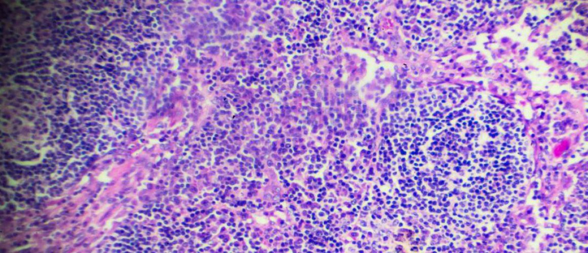 Eosinophils