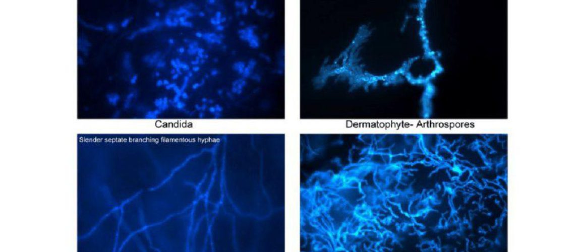 fungal staining