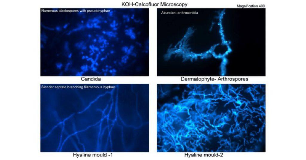 fungal staining