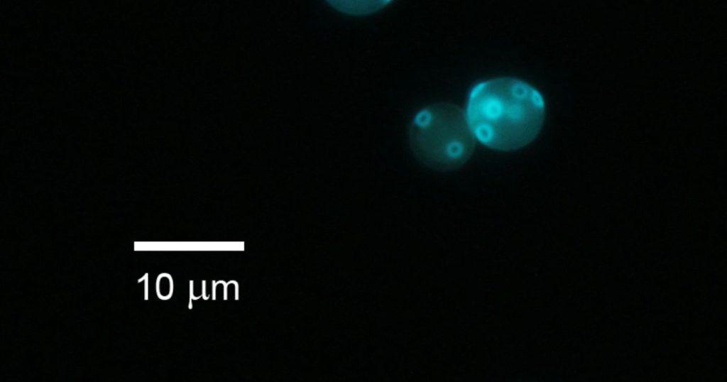 fungal staining