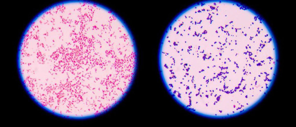 Gram staining