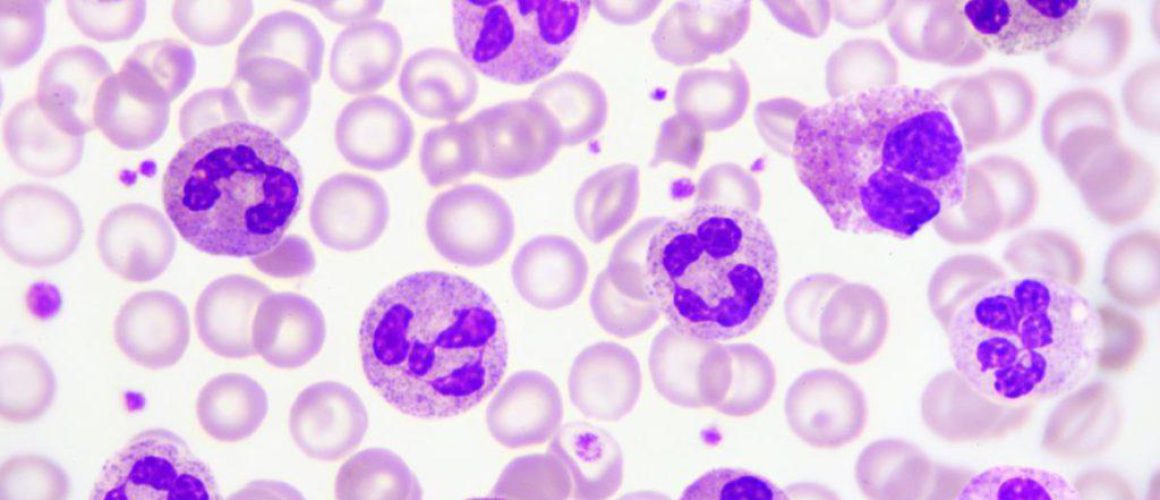 Neutrophils